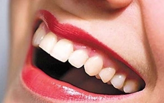 _implantacia-zubov-3